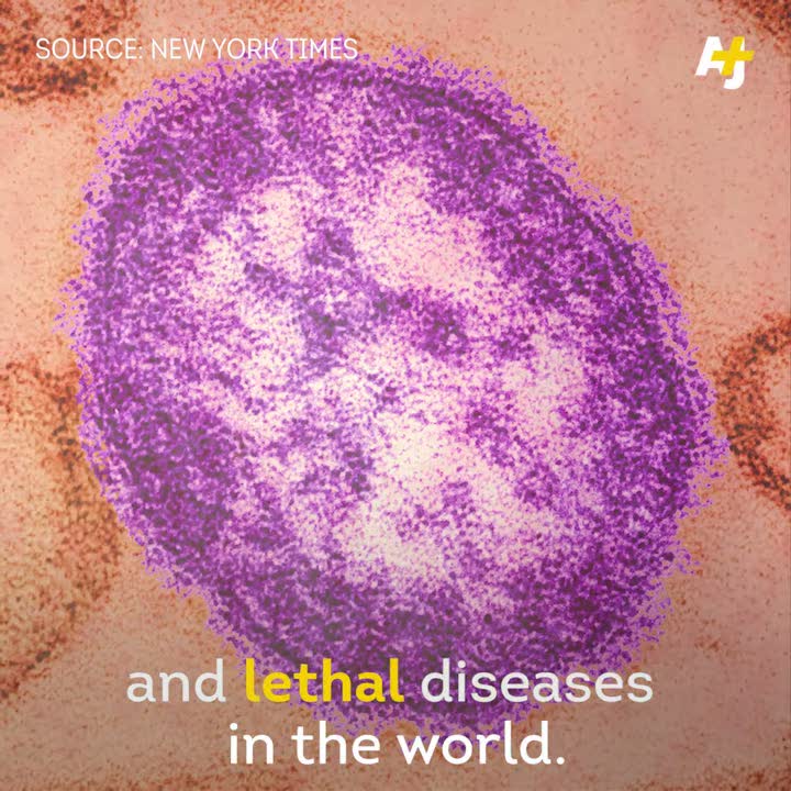 Measles is back in America